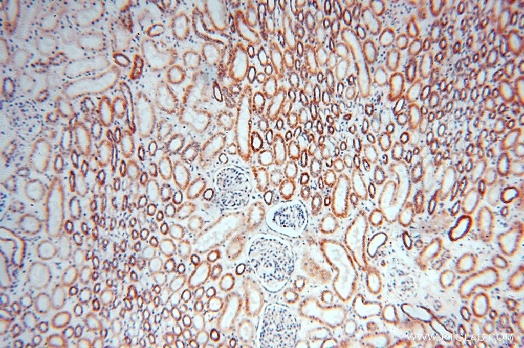Immunohistochemistry (IHC) staining of human kidney tissue using SPATS2L Polyclonal antibody (16938-1-AP)