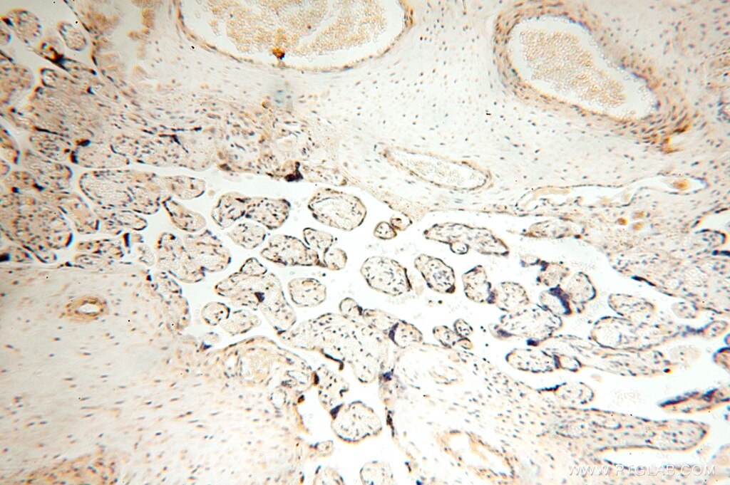 Immunohistochemistry (IHC) staining of human placenta tissue using SPATS2L Polyclonal antibody (16938-1-AP)