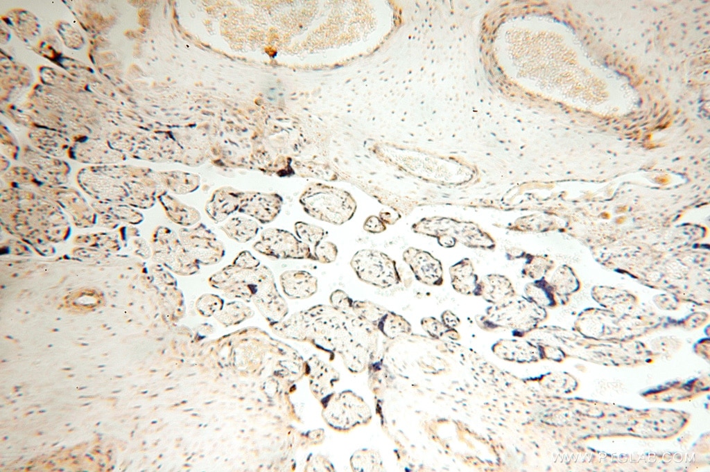 IHC staining of human placenta using 16938-1-AP