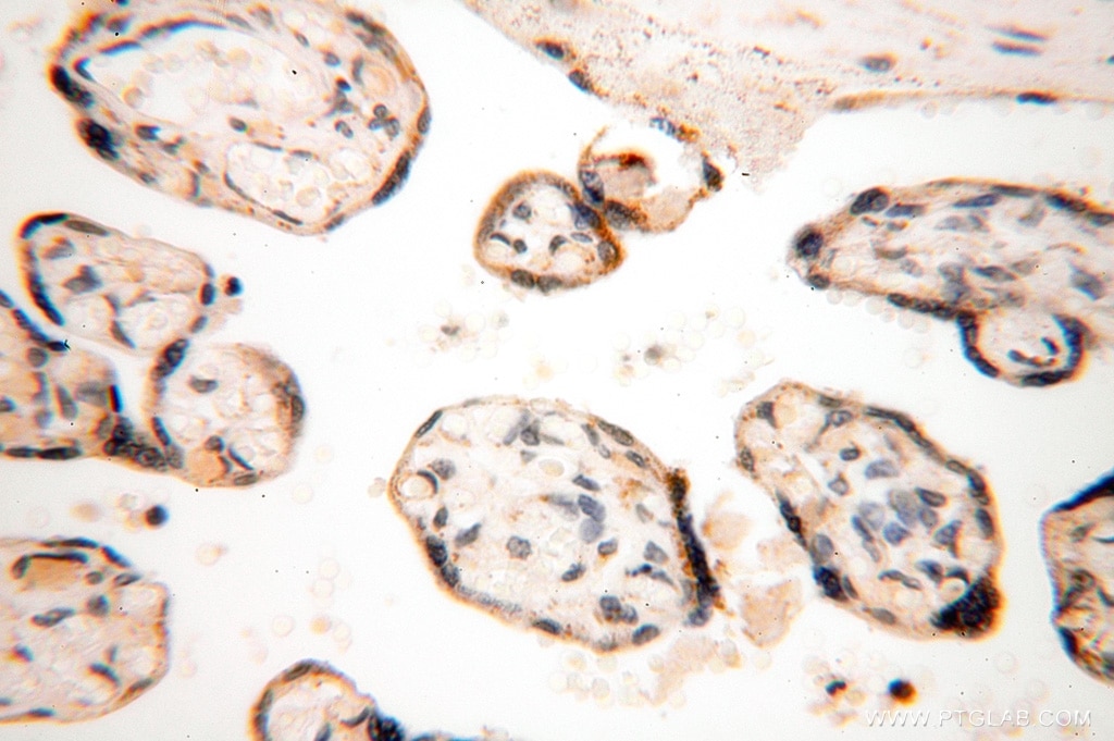 Immunohistochemistry (IHC) staining of human placenta tissue using SPATS2L Polyclonal antibody (16938-1-AP)