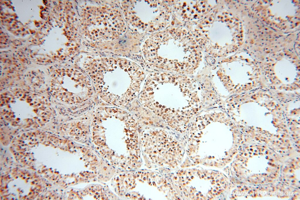 Immunohistochemistry (IHC) staining of human testis tissue using SPATS2L Polyclonal antibody (16938-1-AP)