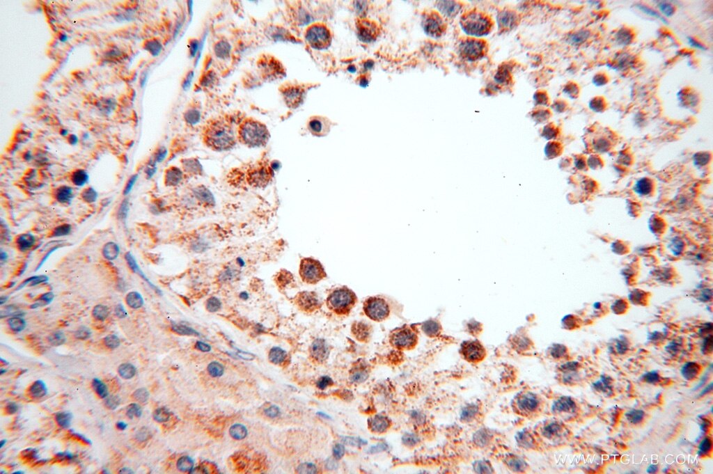 Immunohistochemistry (IHC) staining of human testis tissue using SPATS2L Polyclonal antibody (16938-1-AP)