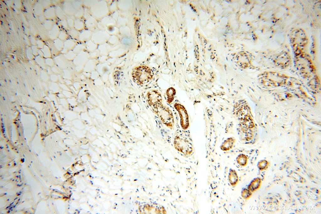 Immunohistochemistry (IHC) staining of human skin tissue using SPATS2L Polyclonal antibody (16938-1-AP)