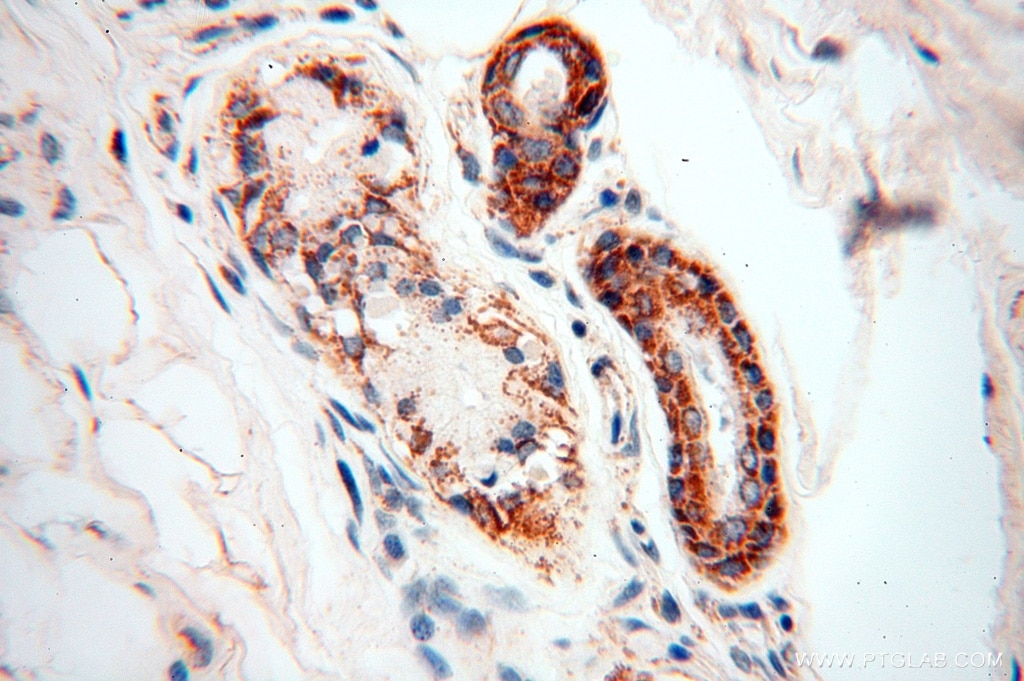 Immunohistochemistry (IHC) staining of human skin tissue using SPATS2L Polyclonal antibody (16938-1-AP)