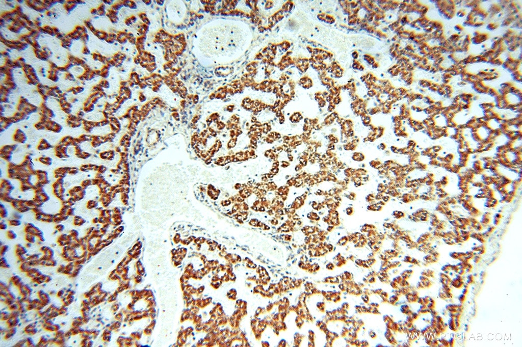 Immunohistochemistry (IHC) staining of human liver tissue using SPATS2L Polyclonal antibody (16938-1-AP)