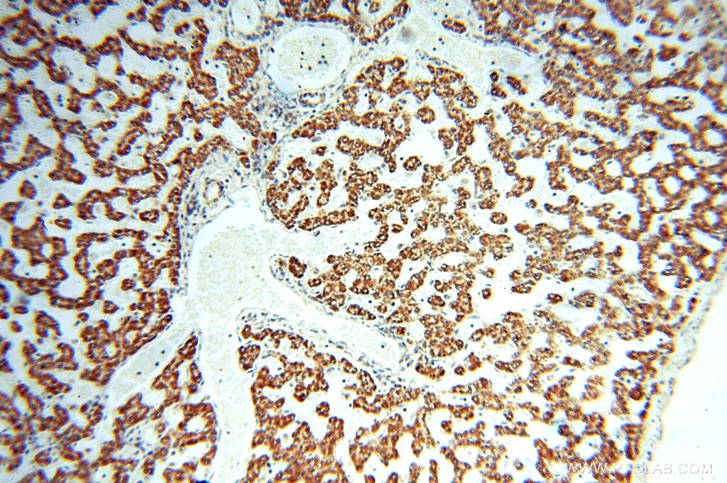 IHC staining of human liver using 16938-1-AP