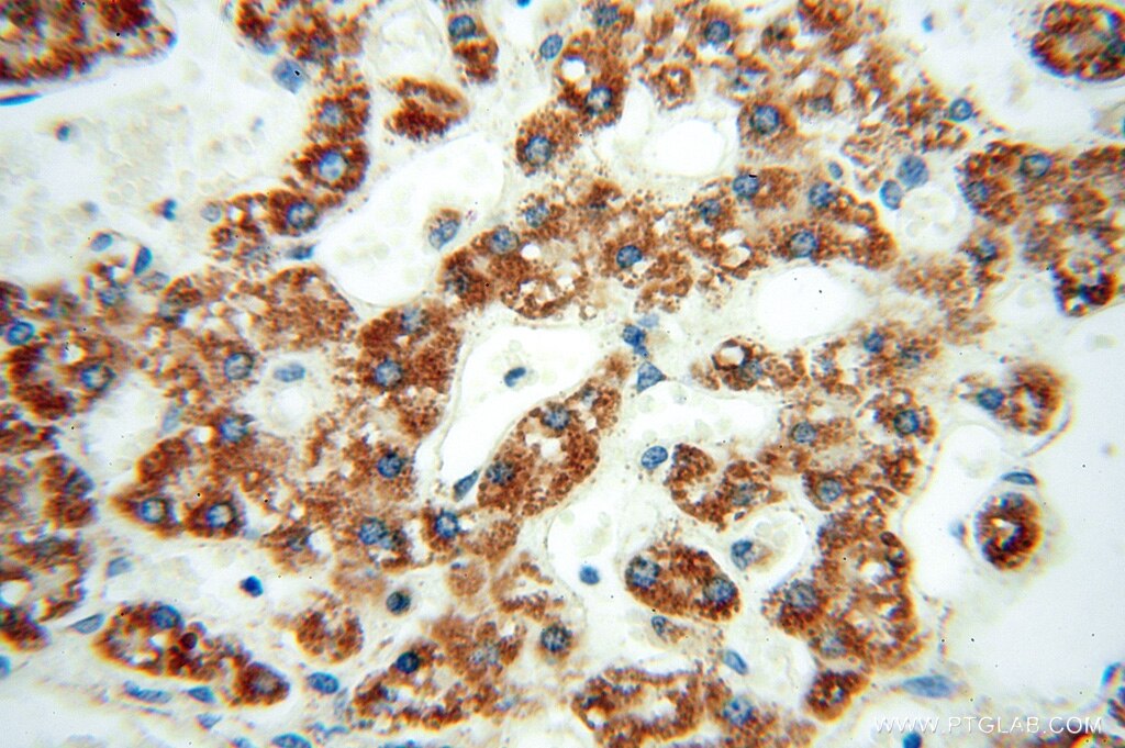 Immunohistochemistry (IHC) staining of human liver tissue using SPATS2L Polyclonal antibody (16938-1-AP)