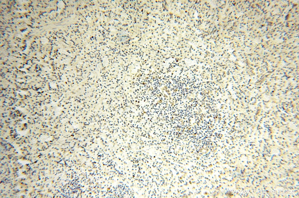Immunohistochemistry (IHC) staining of human spleen tissue using SPATS2L Polyclonal antibody (16938-1-AP)