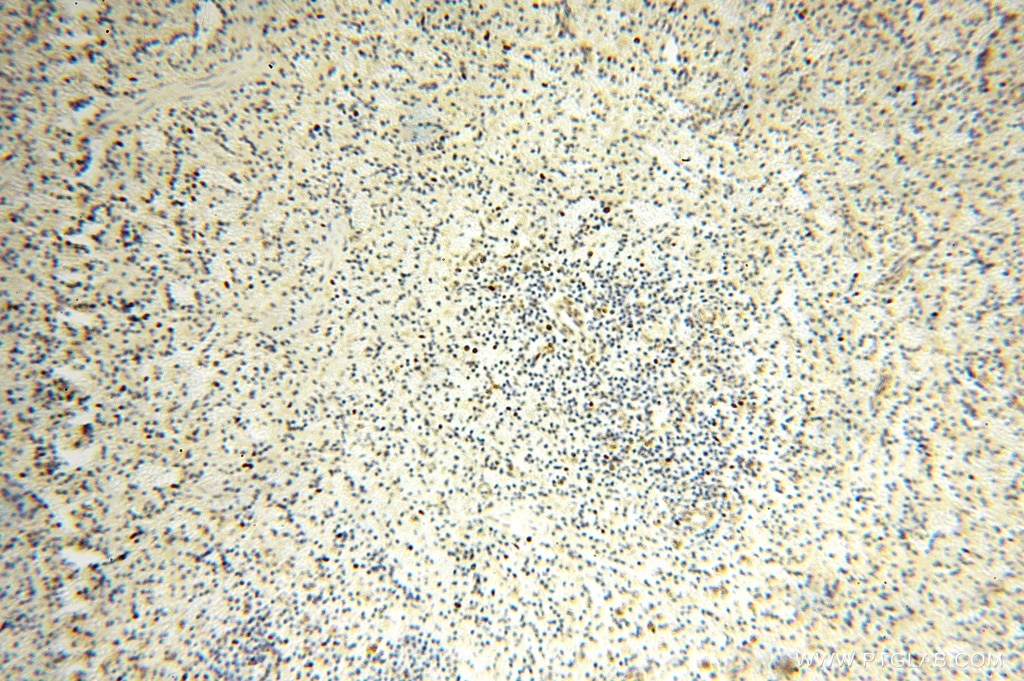 IHC staining of human spleen using 16938-1-AP