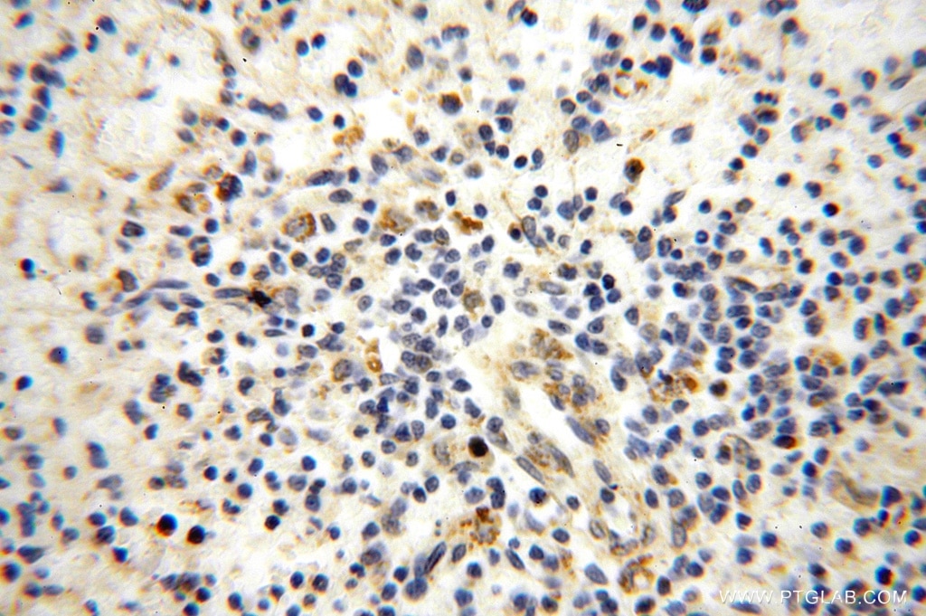 Immunohistochemistry (IHC) staining of human spleen tissue using SPATS2L Polyclonal antibody (16938-1-AP)