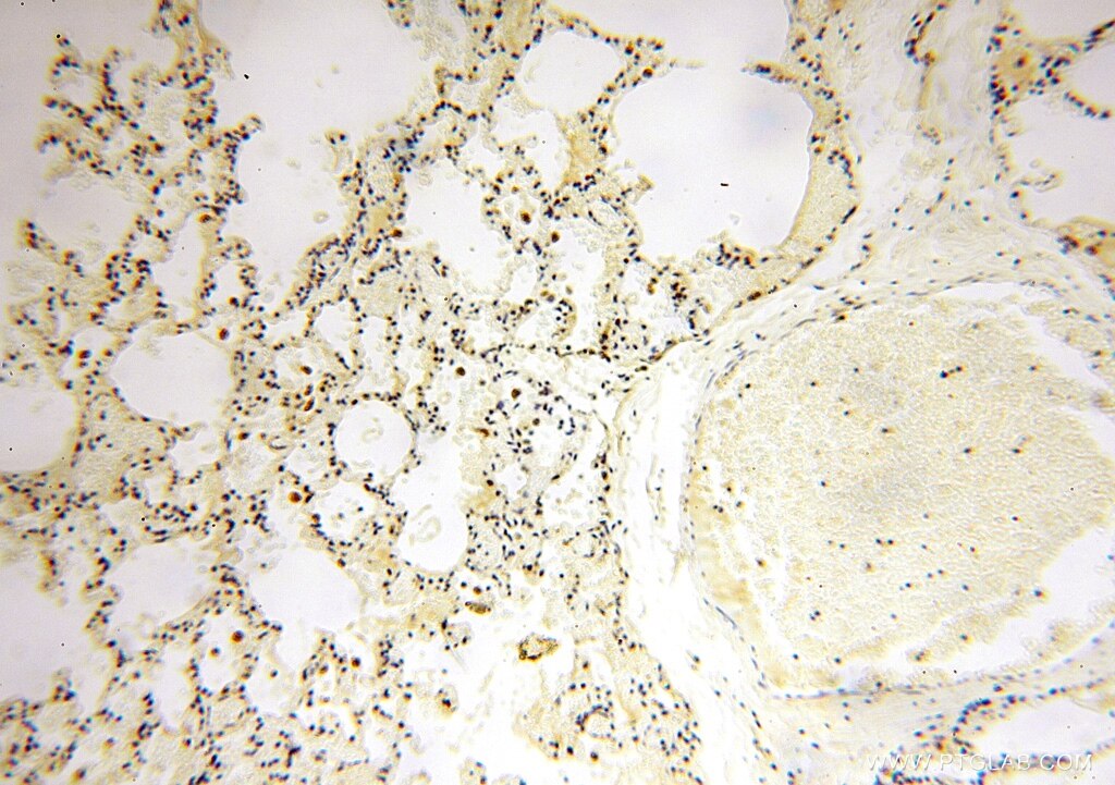 Immunohistochemistry (IHC) staining of human lung tissue using SPATS2L Polyclonal antibody (16938-1-AP)