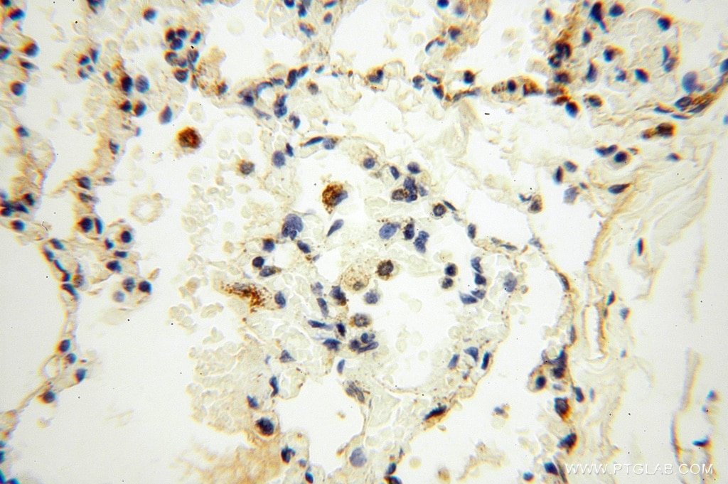 Immunohistochemistry (IHC) staining of human lung tissue using SPATS2L Polyclonal antibody (16938-1-AP)