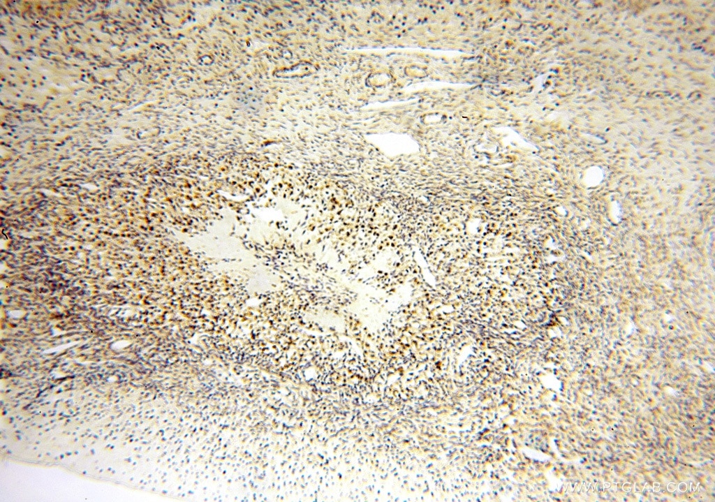 Immunohistochemistry (IHC) staining of human ovary tissue using SPATS2L Polyclonal antibody (16938-1-AP)