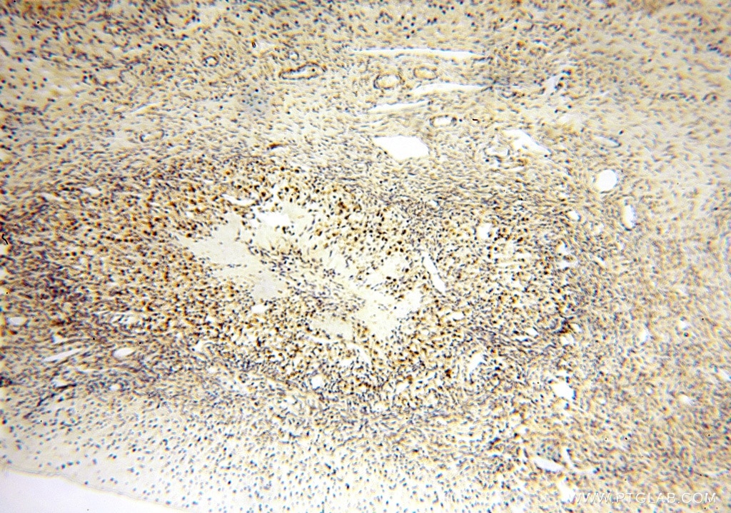 IHC staining of human ovary using 16938-1-AP