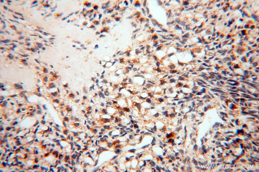 Immunohistochemistry (IHC) staining of human ovary tissue using SPATS2L Polyclonal antibody (16938-1-AP)
