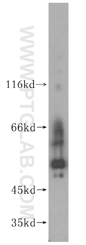 Western Blot (WB) analysis of mouse kidney tissue using SPATS2L Polyclonal antibody (16938-1-AP)