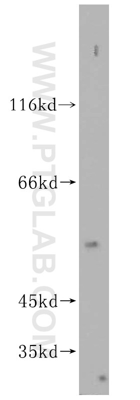 Western Blot (WB) analysis of HepG2 cells using SPATS2L Polyclonal antibody (16938-1-AP)