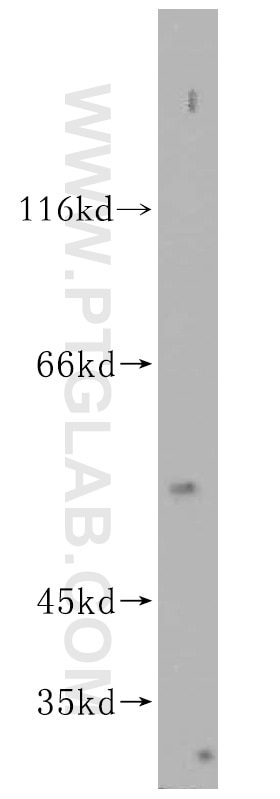 WB analysis of HepG2 using 16938-1-AP