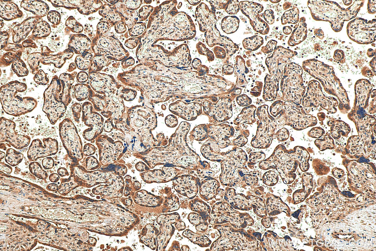 Immunohistochemistry (IHC) staining of human placenta tissue using SPATS2L Polyclonal antibody (29930-1-AP)