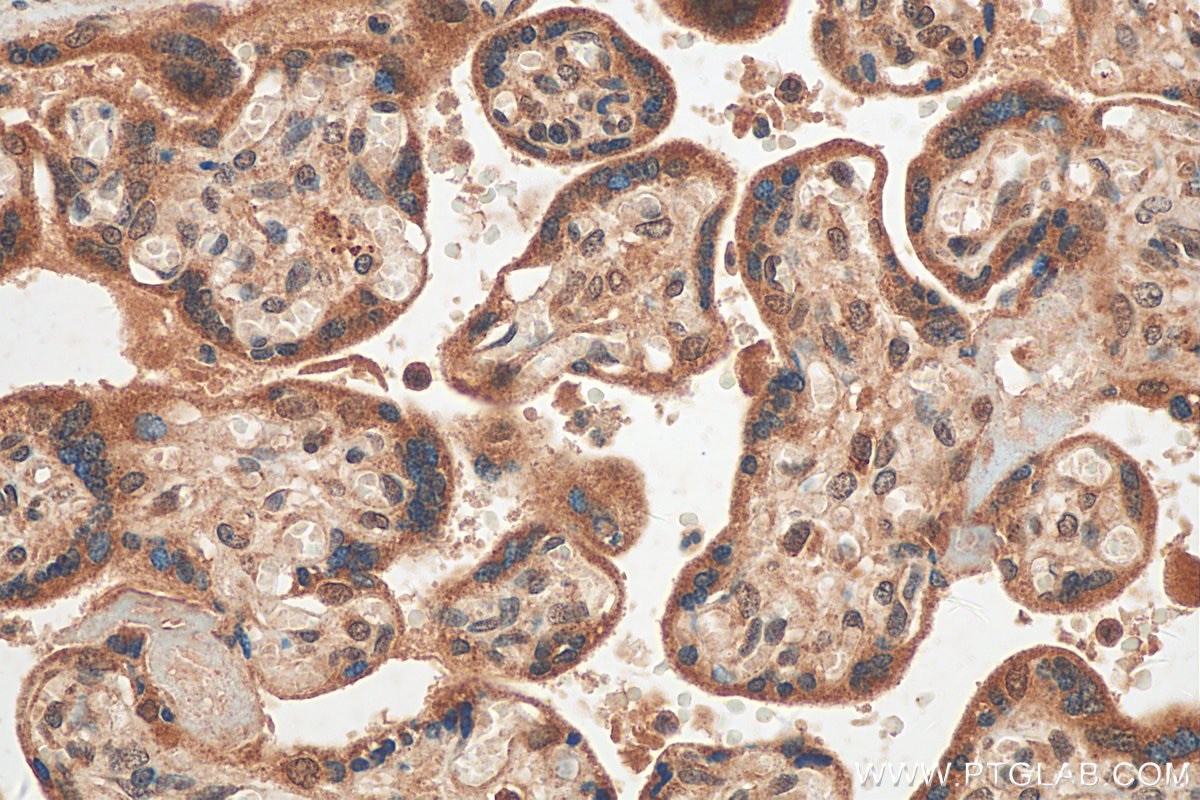 IHC staining of human placenta using 29930-1-AP