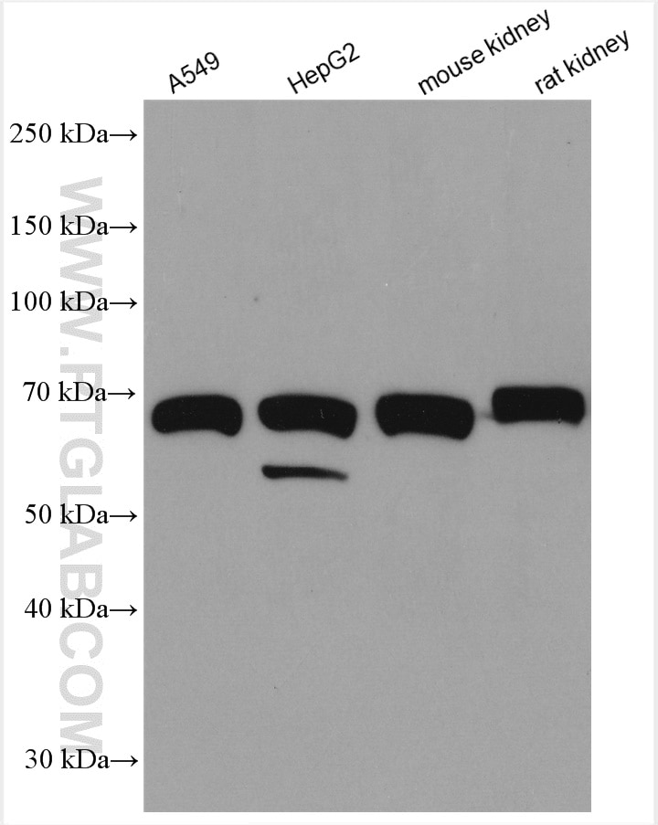 Western Blot (WB) analysis of various lysates using SPATS2L Polyclonal antibody (29930-1-AP)