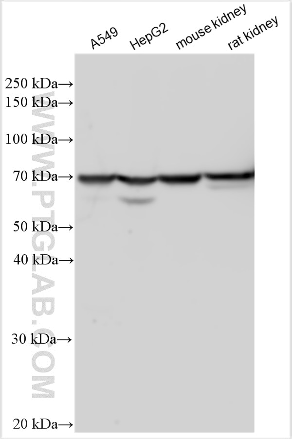 Western Blot (WB) analysis of various lysates using SPATS2L Polyclonal antibody (29930-1-AP)