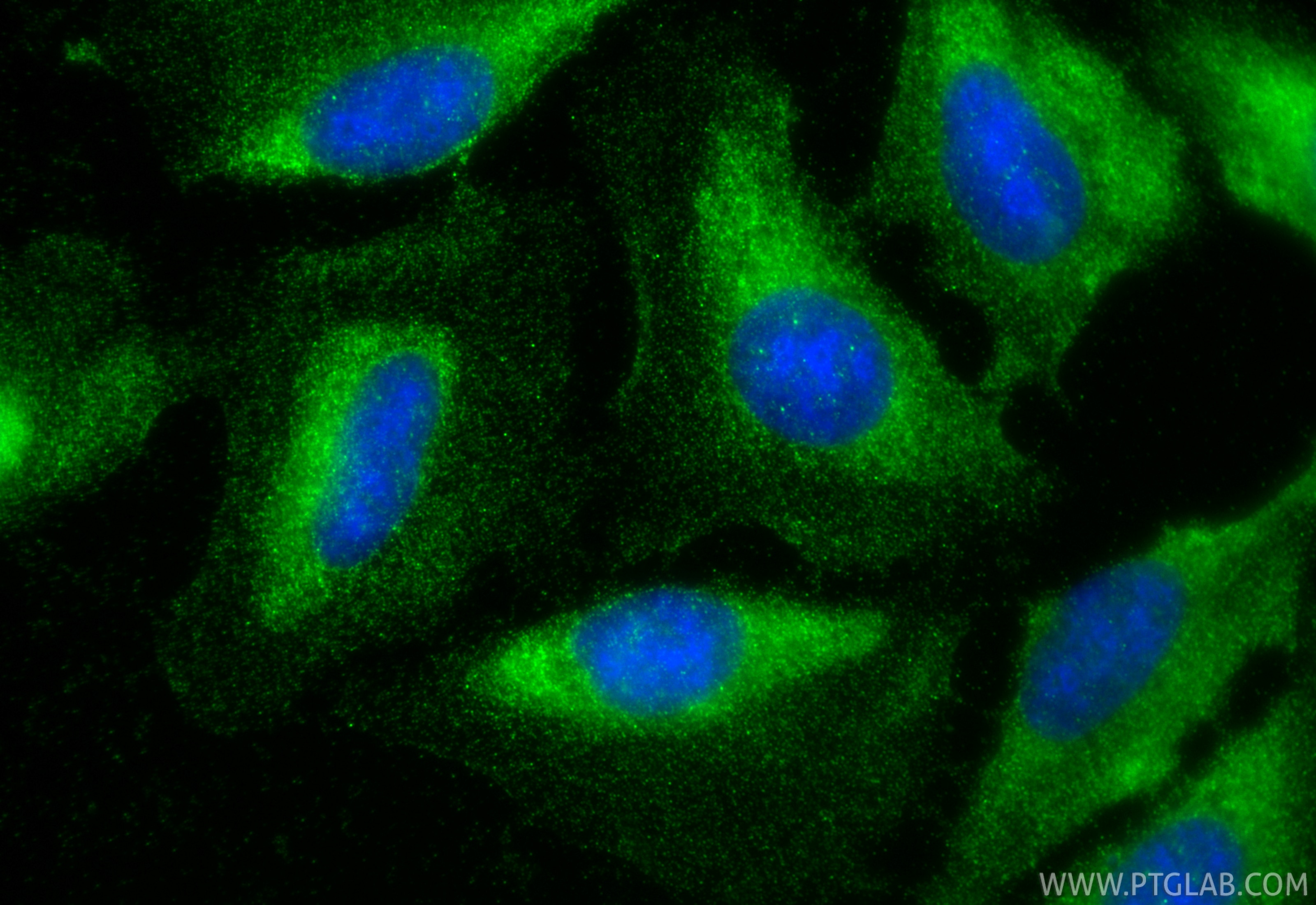 Immunofluorescence (IF) / fluorescent staining of U2OS cells using SPC25 Polyclonal antibody (26474-1-AP)