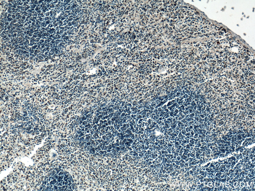 Immunohistochemistry (IHC) staining of mouse spleen tissue using SPC25 Polyclonal antibody (26474-1-AP)