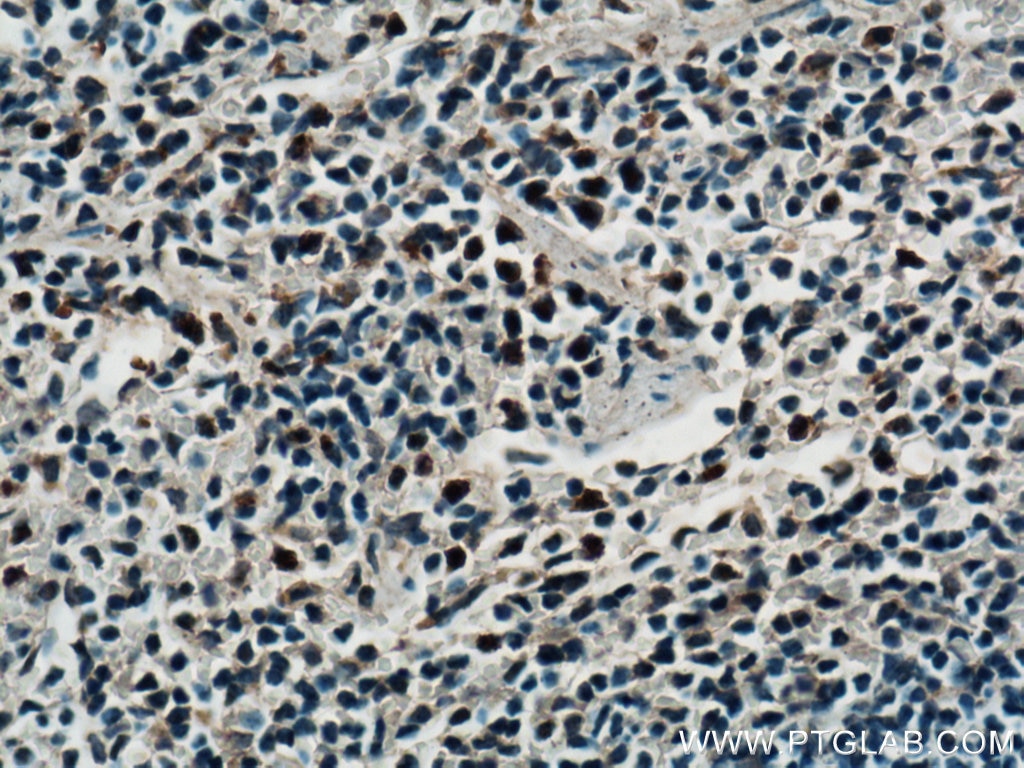 Immunohistochemistry (IHC) staining of mouse spleen tissue using SPC25 Polyclonal antibody (26474-1-AP)