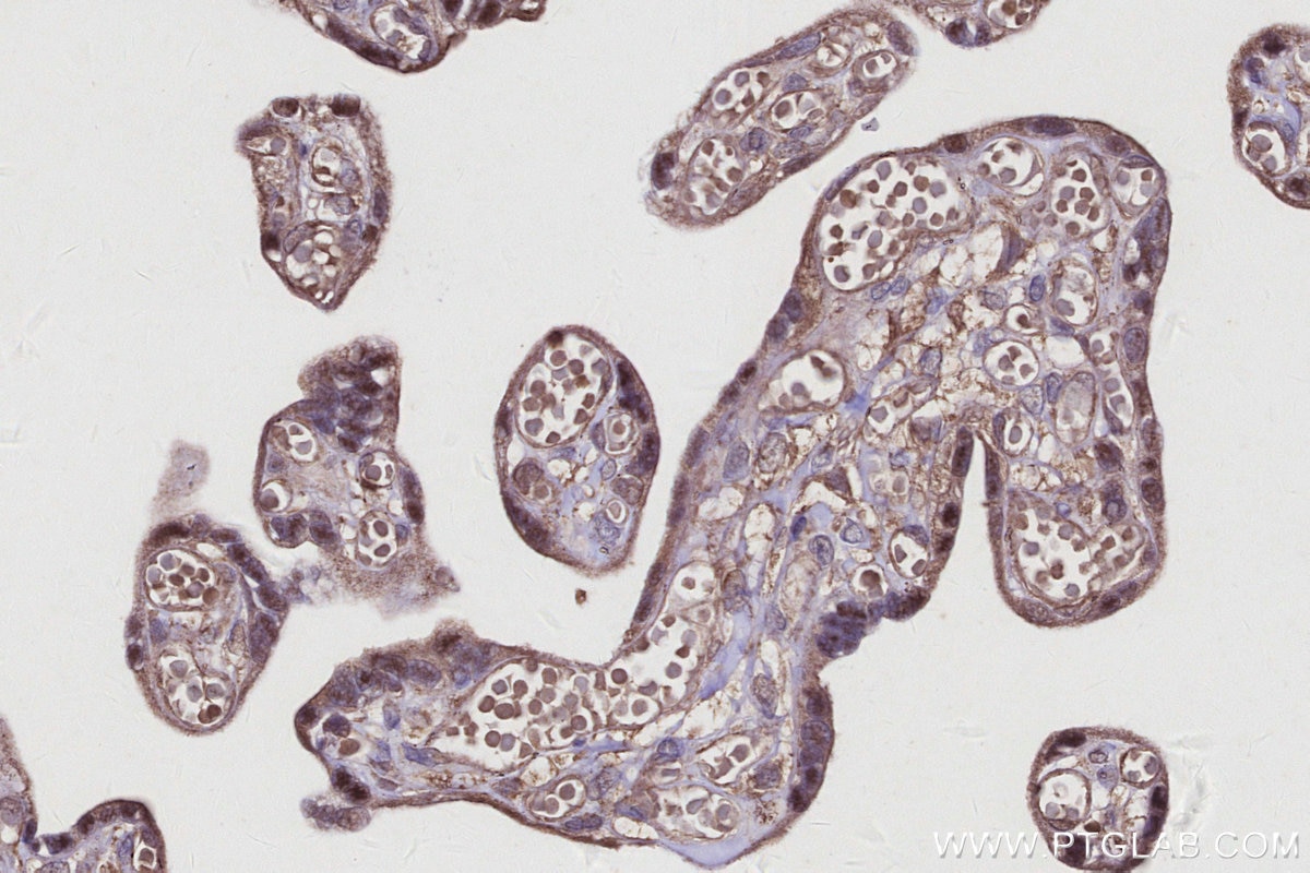 Immunohistochemistry (IHC) staining of human placenta tissue using SPC25 Polyclonal antibody (26474-1-AP)
