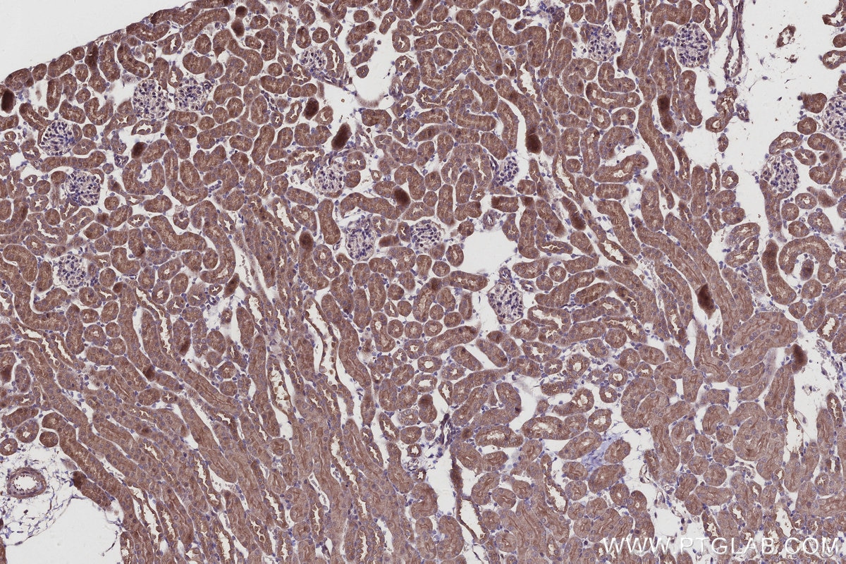 Immunohistochemistry (IHC) staining of mouse kidney tissue using SPC25 Polyclonal antibody (26474-1-AP)