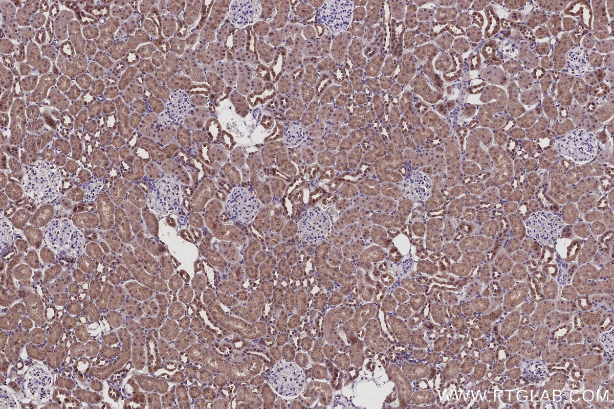 Immunohistochemistry (IHC) staining of rat kidney tissue using SPC25 Polyclonal antibody (26474-1-AP)