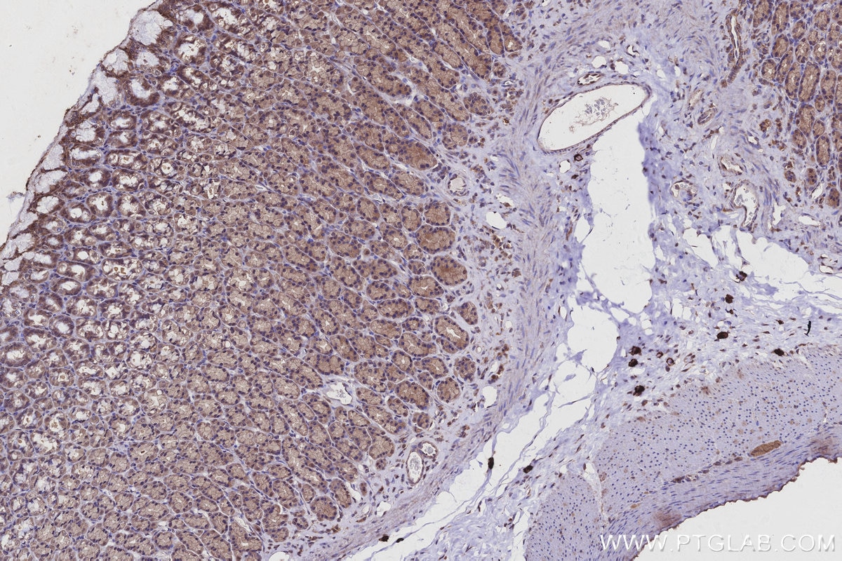 Immunohistochemistry (IHC) staining of rat stomach tissue using SPC25 Polyclonal antibody (26474-1-AP)