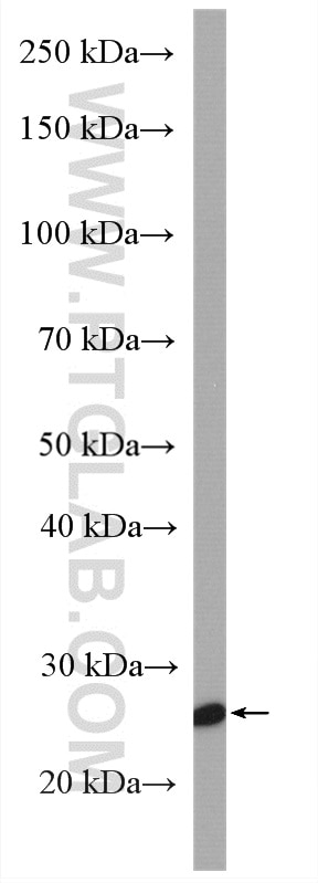 Western Blot (WB) analysis of HL-60 cells using SPC25 Polyclonal antibody (26474-1-AP)