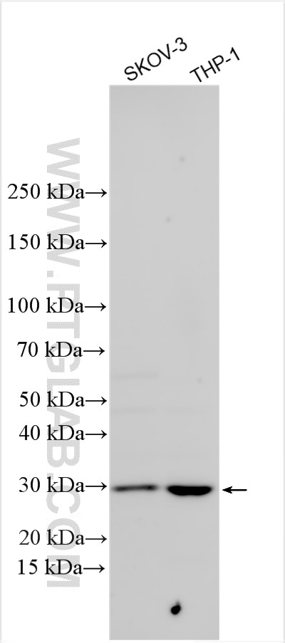 Western Blot (WB) analysis of various lysates using SPC25 Polyclonal antibody (26474-1-AP)