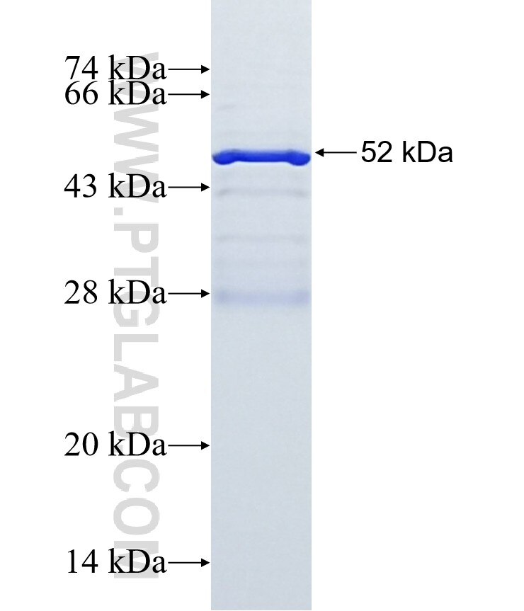 SPC25 fusion protein Ag23985 SDS-PAGE