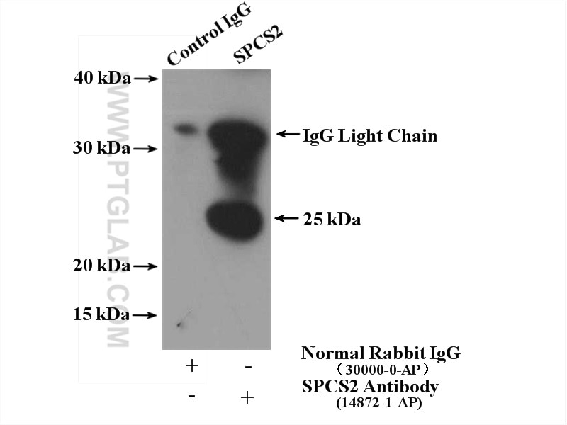 Immunoprecipitation (IP) experiment of mouse colon tissue using SPCS2 Polyclonal antibody (14872-1-AP)