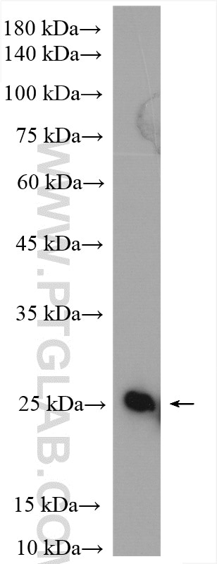 Western Blot (WB) analysis of mouse stomach tissue using SPCS2 Polyclonal antibody (14872-1-AP)