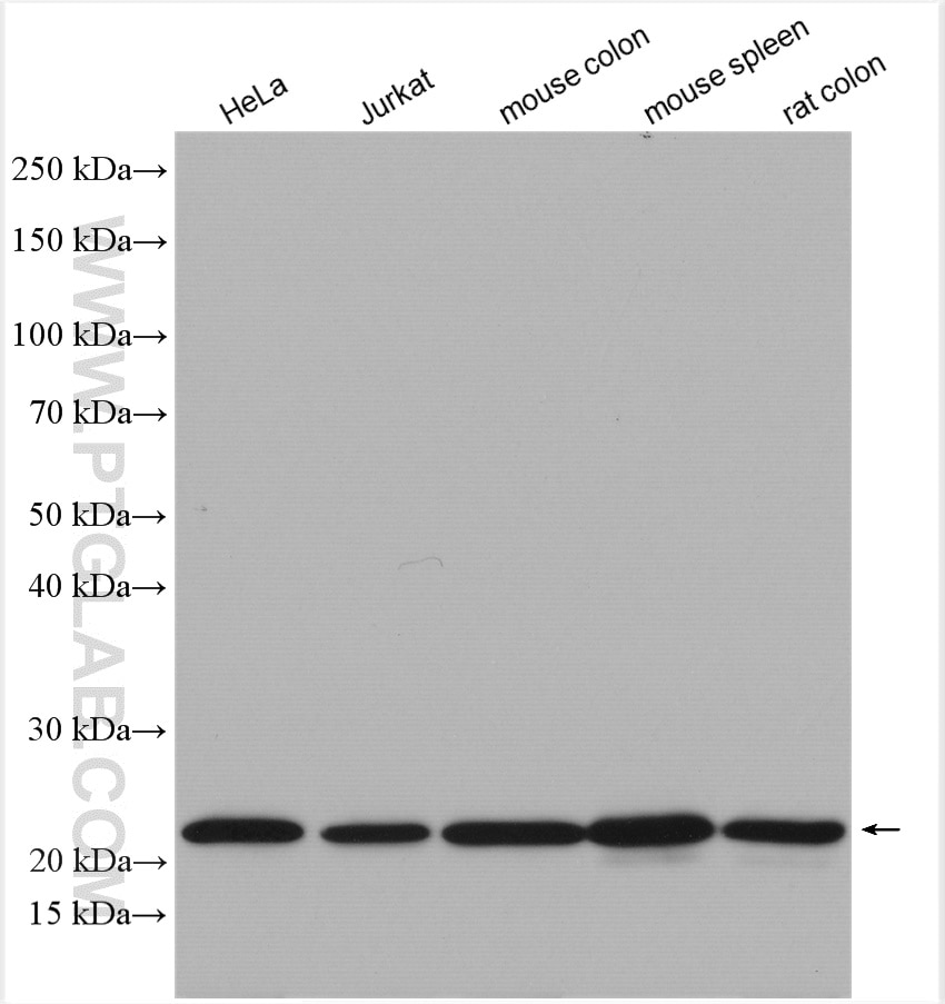 Western Blot (WB) analysis of various lysates using SPCS2 Polyclonal antibody (14872-1-AP)