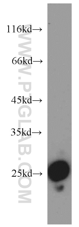 Western Blot (WB) analysis of human colon tissue using SPCS2 Polyclonal antibody (14872-1-AP)