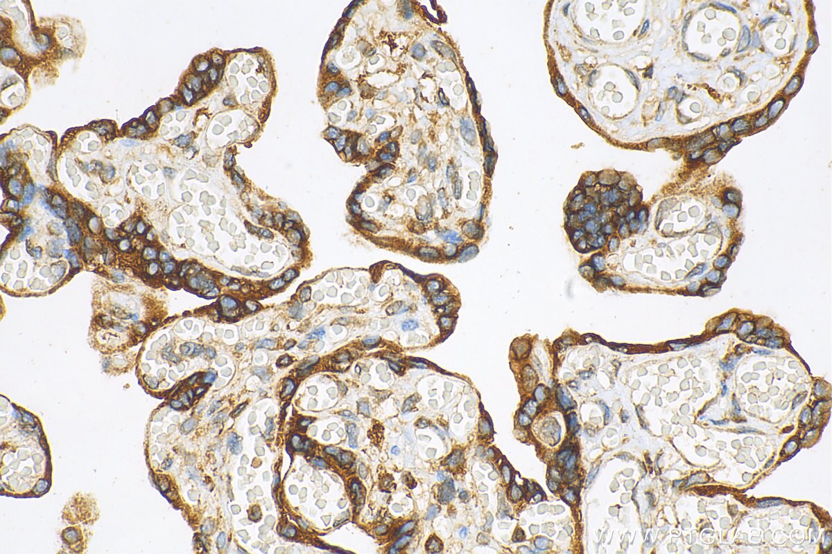 Immunohistochemistry (IHC) staining of human placenta tissue using SPCS3 Polyclonal antibody (17640-1-AP)