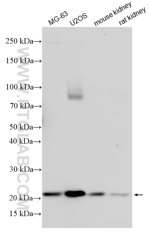Western Blot (WB) analysis of various lysates using SPCS3 Polyclonal antibody (17640-1-AP)