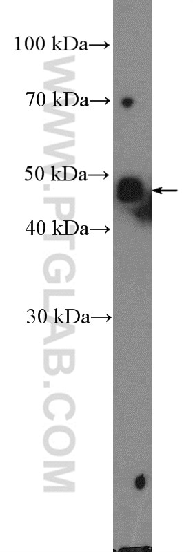 WB analysis of MCF-7 using 11467-1-AP