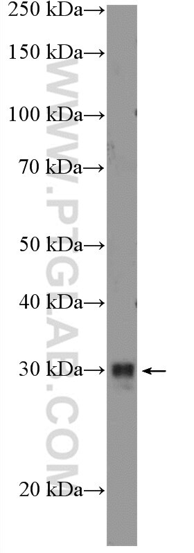 Western Blot (WB) analysis of Neuro-2a cells using SPDYA Polyclonal antibody (17836-1-AP)