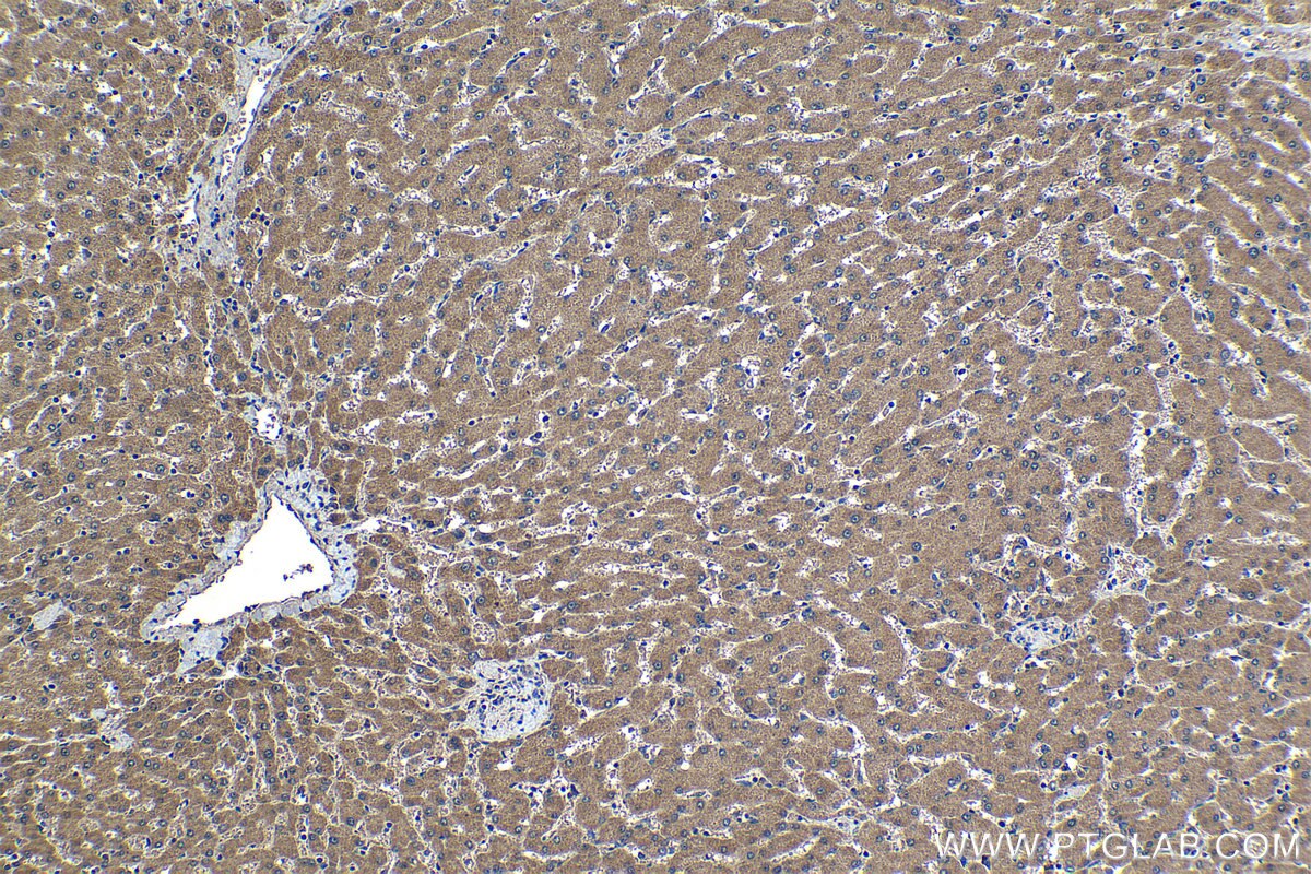 Immunohistochemistry (IHC) staining of human liver tissue using SPDYC Polyclonal antibody (22471-1-AP)