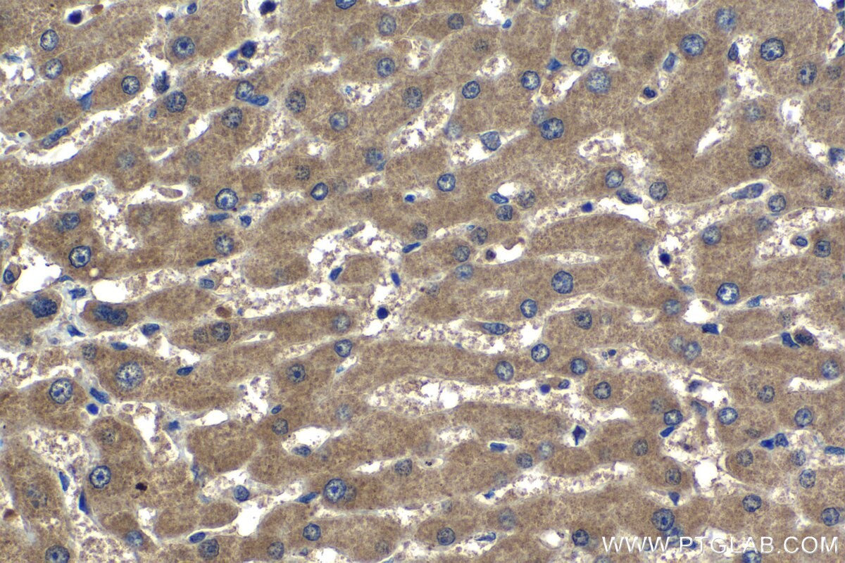 Immunohistochemistry (IHC) staining of human liver tissue using SPDYC Polyclonal antibody (22471-1-AP)