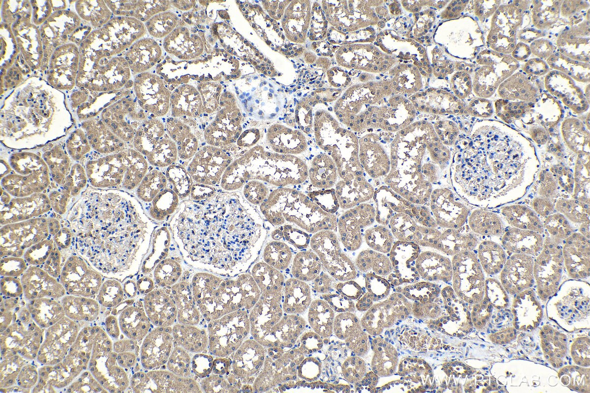 Immunohistochemistry (IHC) staining of human kidney tissue using SPDYC Polyclonal antibody (22471-1-AP)