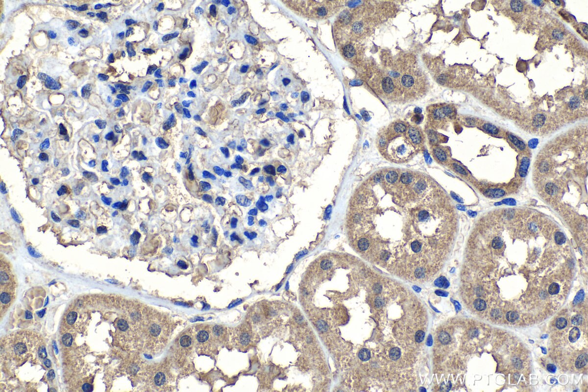Immunohistochemistry (IHC) staining of human kidney tissue using SPDYC Polyclonal antibody (22471-1-AP)