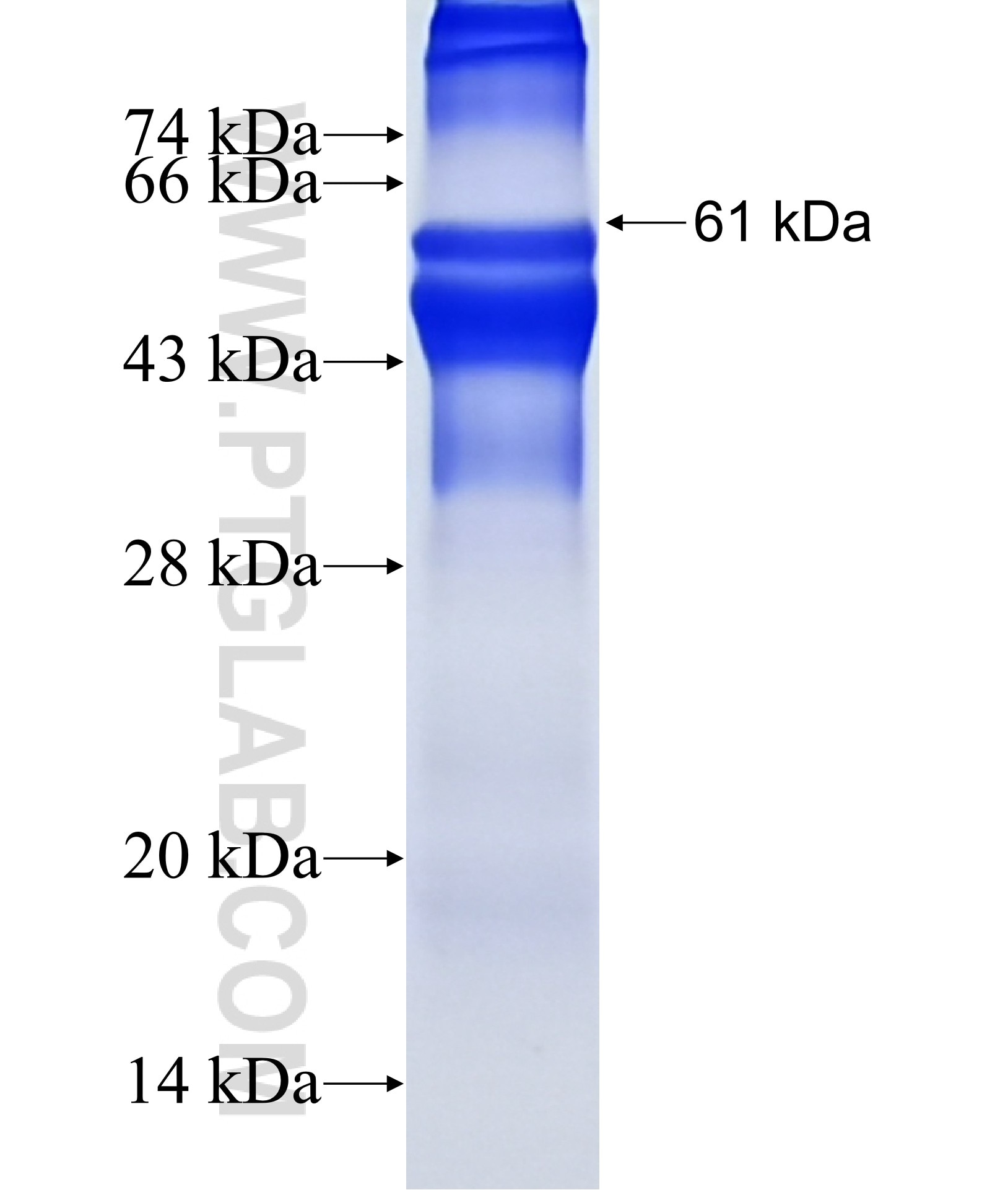 SPDYC fusion protein Ag18126 SDS-PAGE