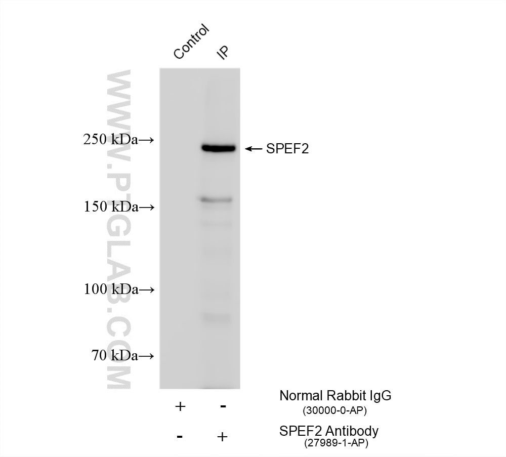 Immunoprecipitation (IP) experiment of rat testis tissue using SPEF2 Polyclonal antibody (27989-1-AP)